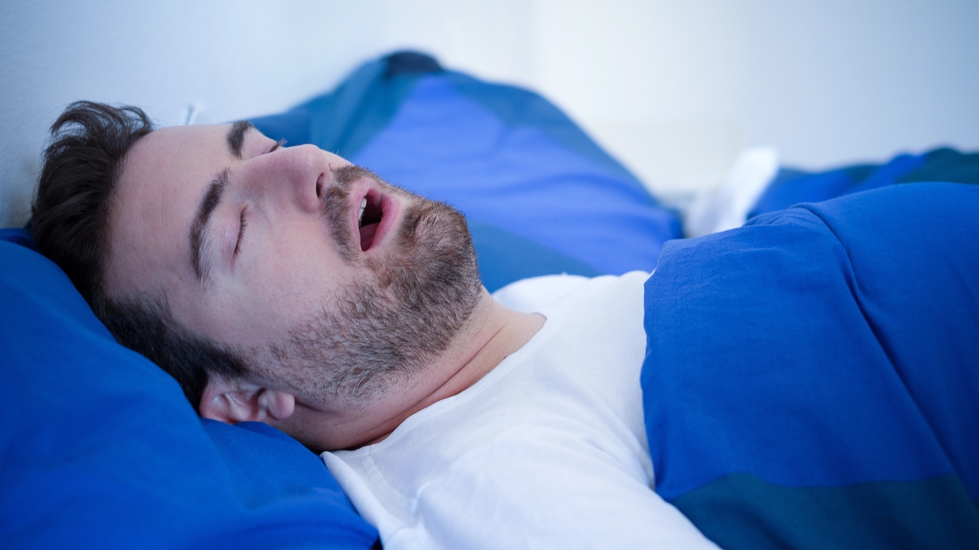 man sleeping with mouth open