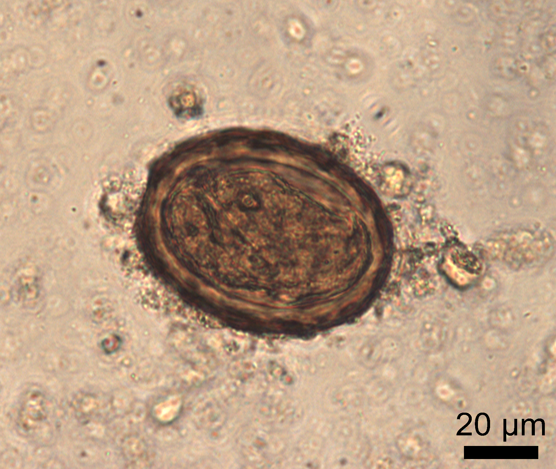 a roundworm egg underneath a microscope. it is a brown slightly oval shaped egg