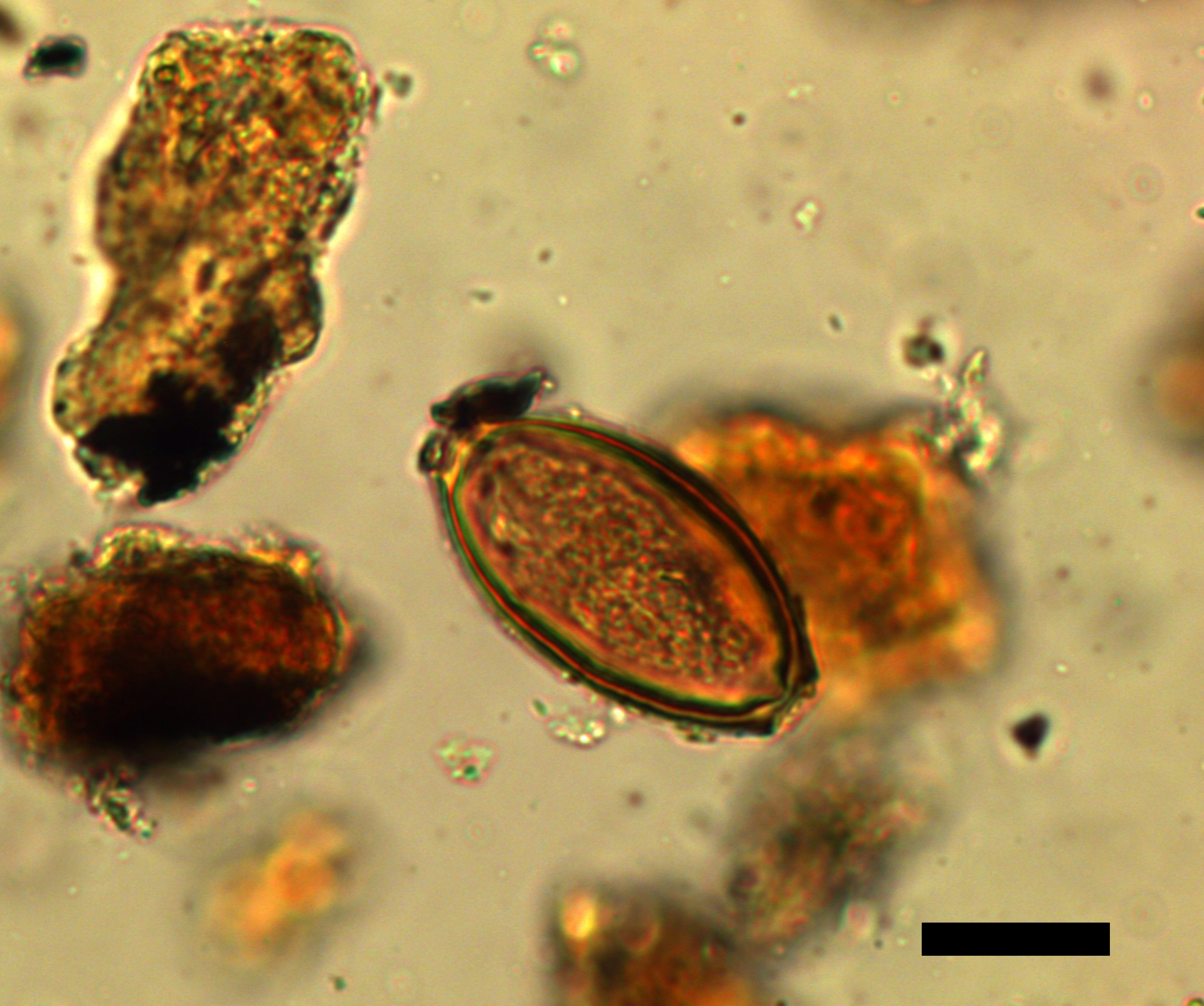 a whipwom egg under a microscope. it is an oval shaped and amber colored egg of a parsite