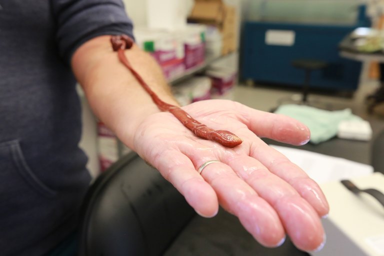 a worm on a person's hand