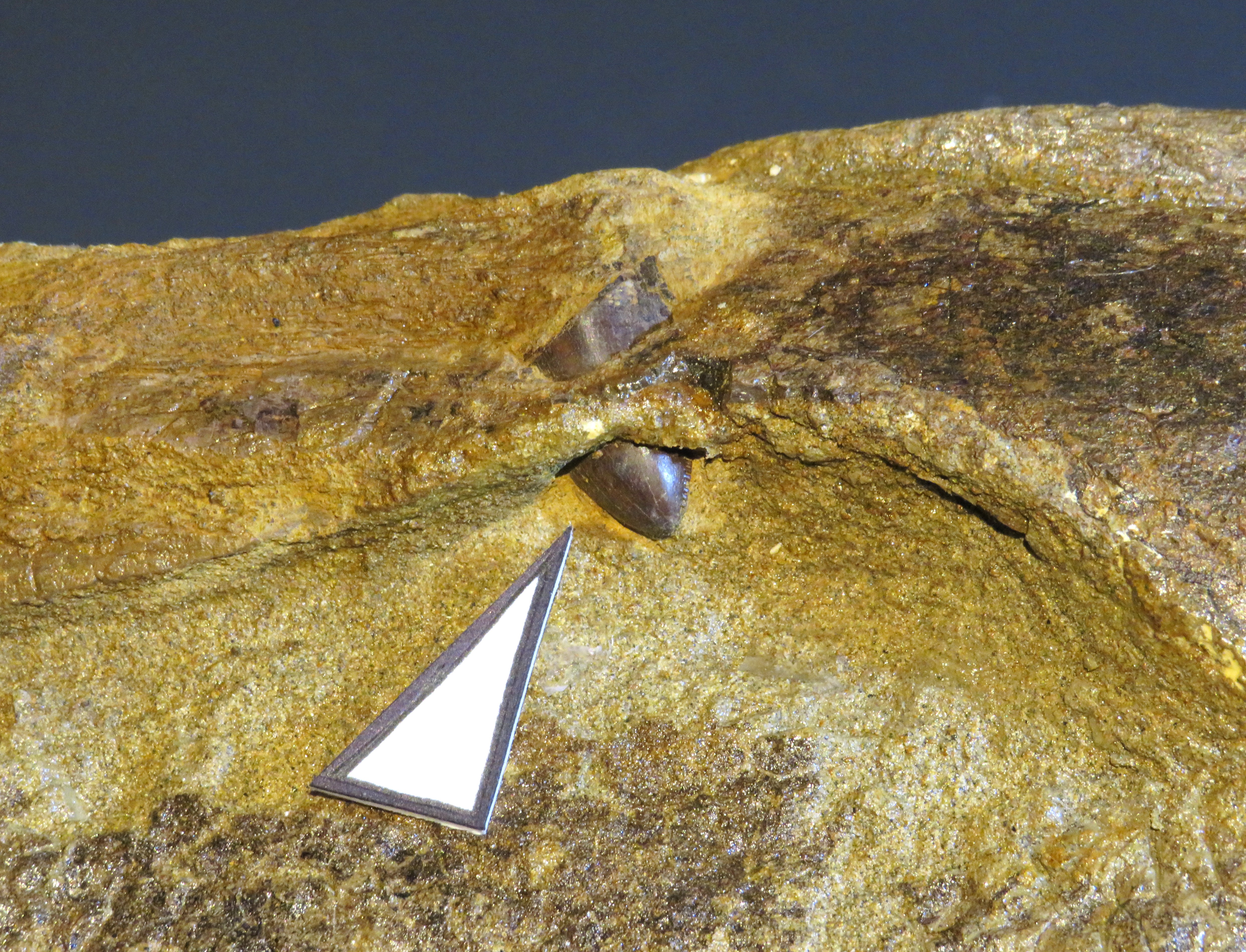 a tooth loged in a skull