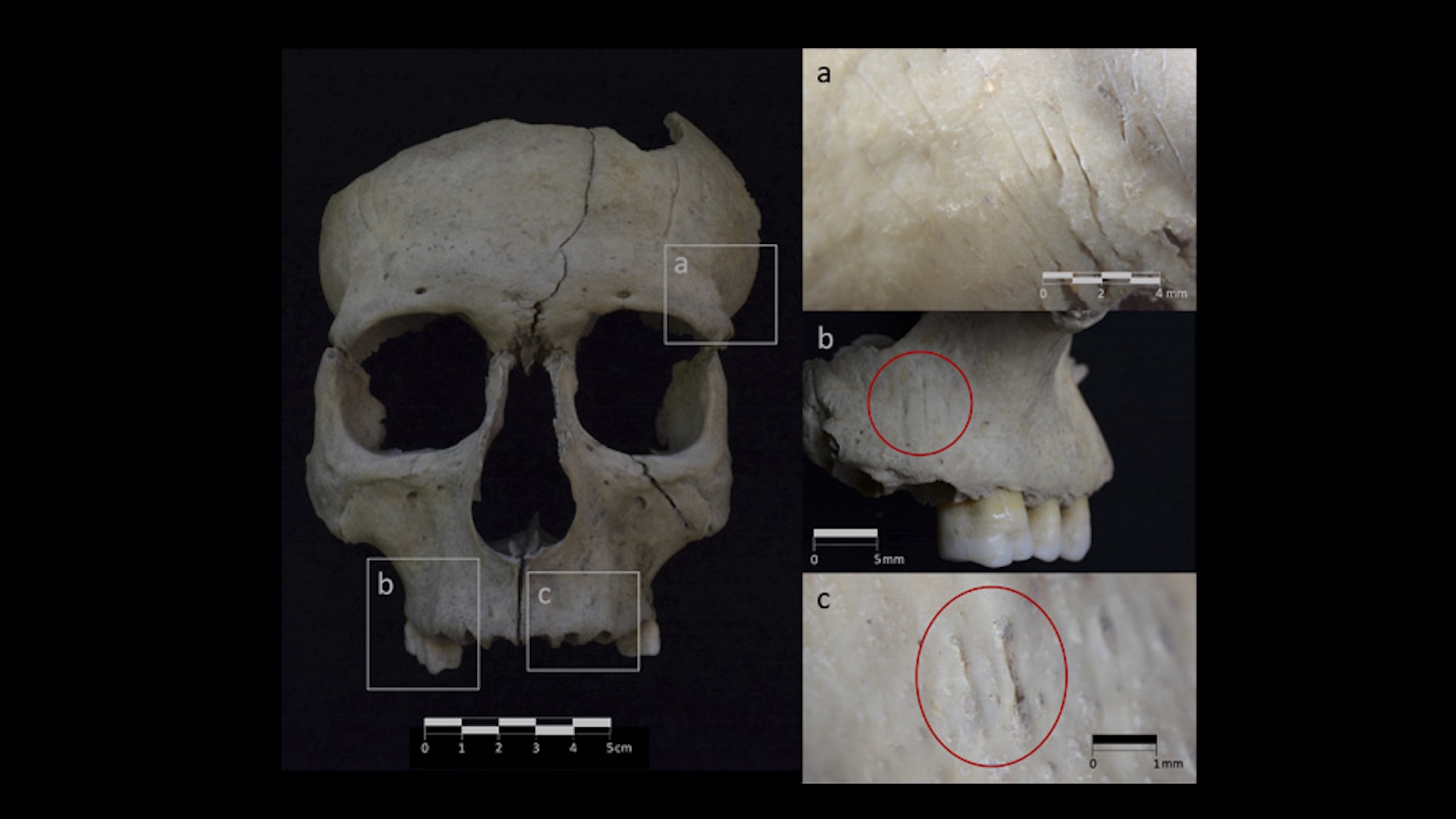Scans of severed skull fragments from Iberian Peninsula