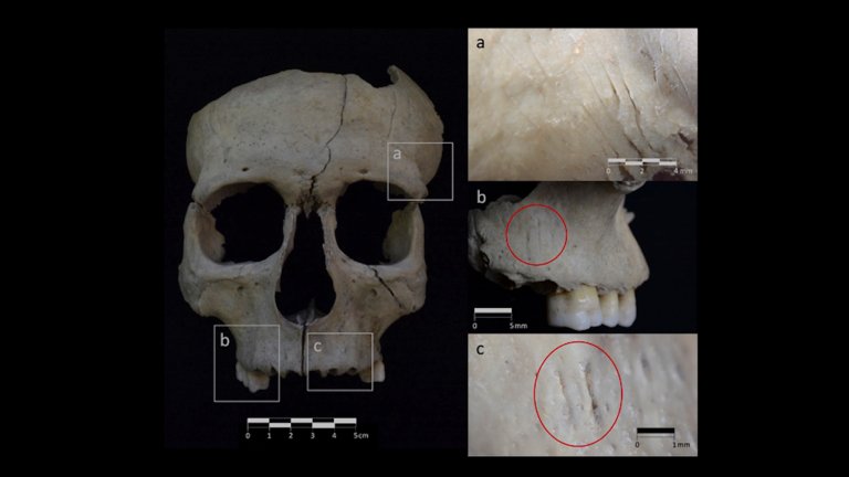 Scans of severed skull fragments from Iberian Peninsula