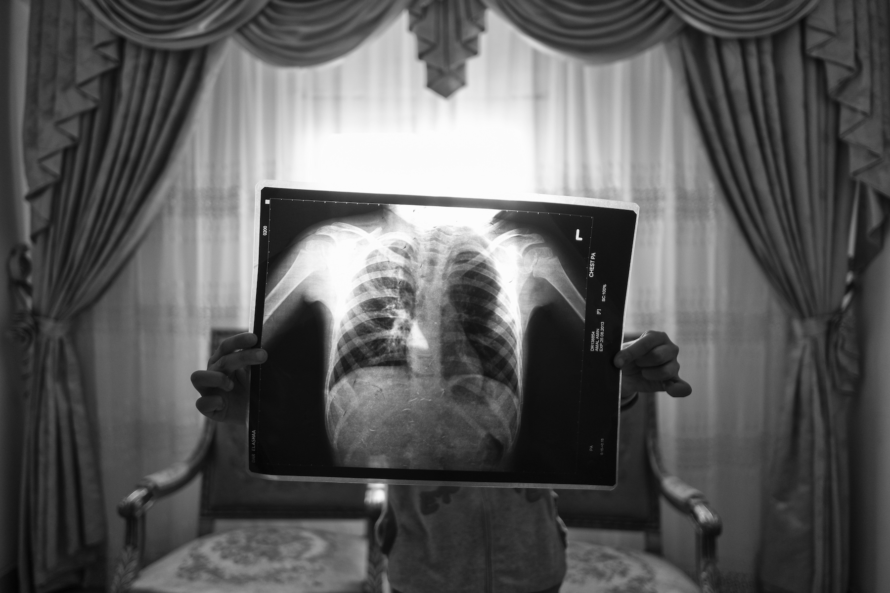 Title: Moon Dust Credit: © Mohamed Mahdy, Arab Documentary Photography Program Caption: Amal holds an X-ray of her lungs. She moved to Moon Valley at three years old and developed asthma within months. Alexandria, Egypt, 31 January 2018. Story: More than 30,000 residents of Wadi El-Qamar, also known as Moon Valley, in western Alexandria, Egypt, live less than 15 meters from a cement factory that fills their homes with toxic dust. Children are born with asthma. Families suffer from lung disease and irreversible respiratory damage. In 2016, the photographer – who lives nearby and has asthma himself – began documenting their stories and ongoing legal battles.