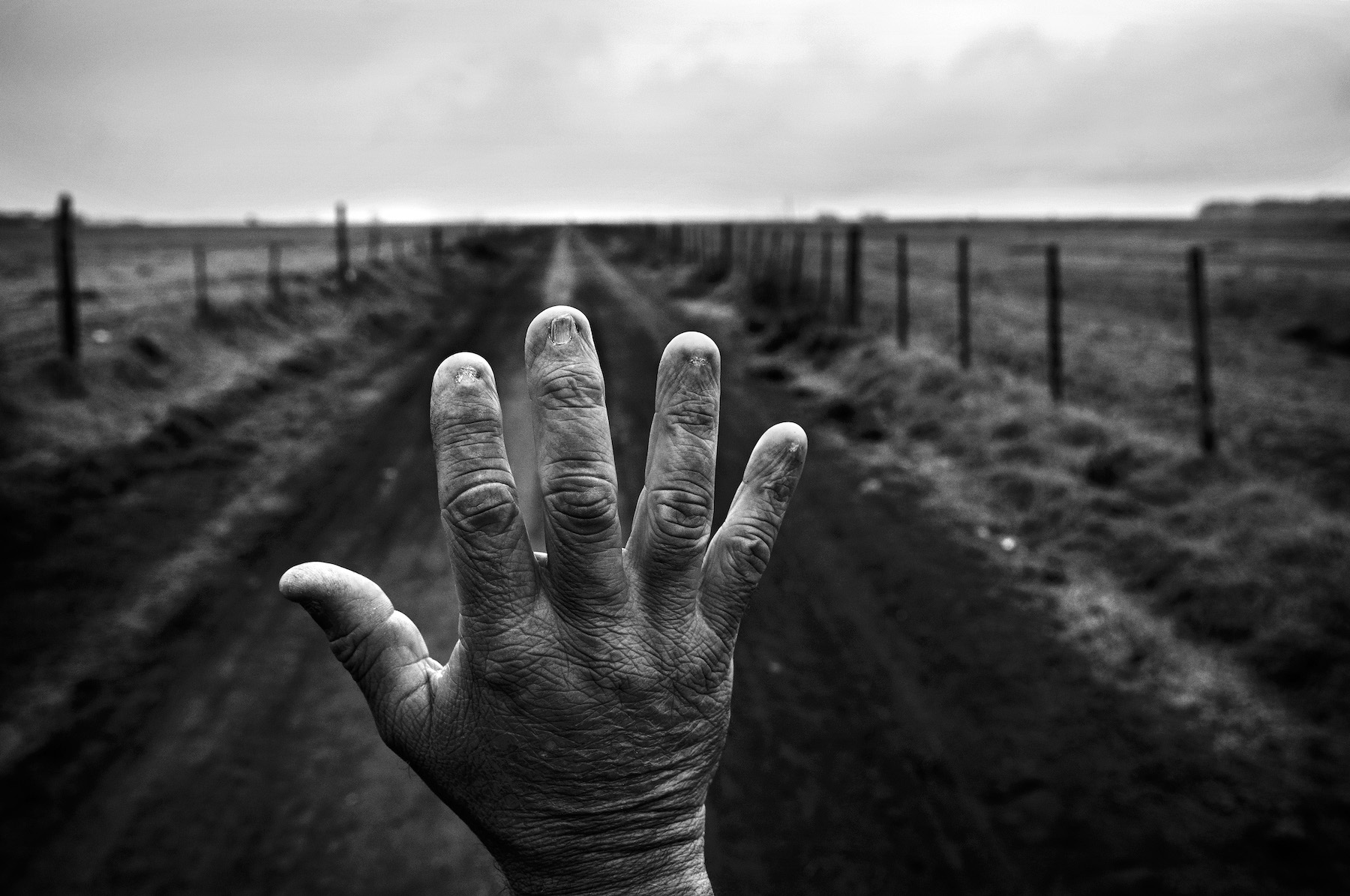 Title: The Human Cost of Agrotoxins Credit: © Pablo E. Piovano, Manuel Rivera-Ortiz Foundation, Philip Jones Griffiths Foundation, Lawen.doc Caption: Former land applicator Alfredo Cerán shows his burned fingernails. After years of mixing chemical products without adequate protection, he developed non-alcoholic cirrhosis and underwent a liver transplant. Cordoba, Argentina, 23 September 2015. Story: In 1996, Argentina approved genetically modified, herbicide-resistant soybeans paired with glyphosate-based herbicides, a policy adopted without independent research. In three decades, pesticide use skyrocketed from 40 million to 580 million liters annually. Today, 60% of Argentina’s cultivated land is sprayed, affecting 14 million people. Despite independent studies linking exposure to increased risks of cancer and congenital malformations, regulations continue to loosen even as agrochemical usage moves closer to human settlements. This project documents the human cost of an economic model that prioritizes agro-industrial profit over the lives of its rural citizens.