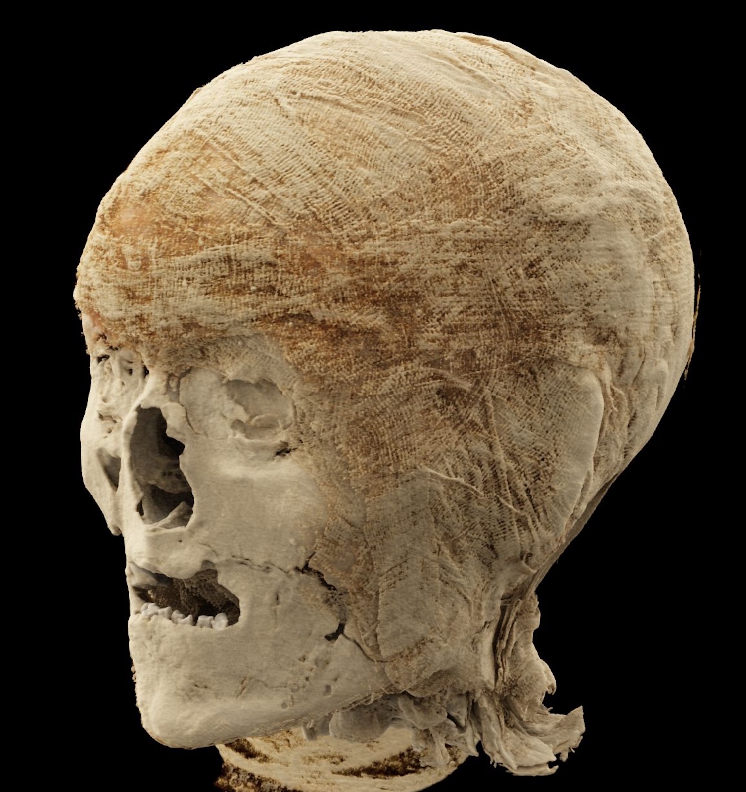 3D CT scan of mummy head and skull