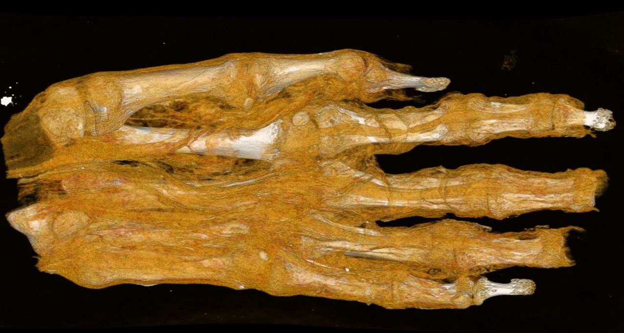 CT scan of mummy hand
