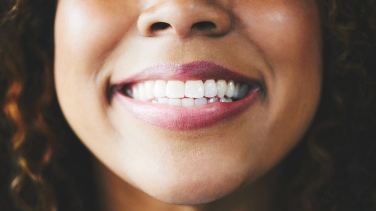 A close-up photograph shows the lower face and smile of a woman with warm-toned skin and curly dark hair. She has a wide, natural smile that reveals a row of straight, bright white teeth. The lighting is soft and flattering, emphasizing the smooth texture of her lips and the healthy appearance of her dental alignment.