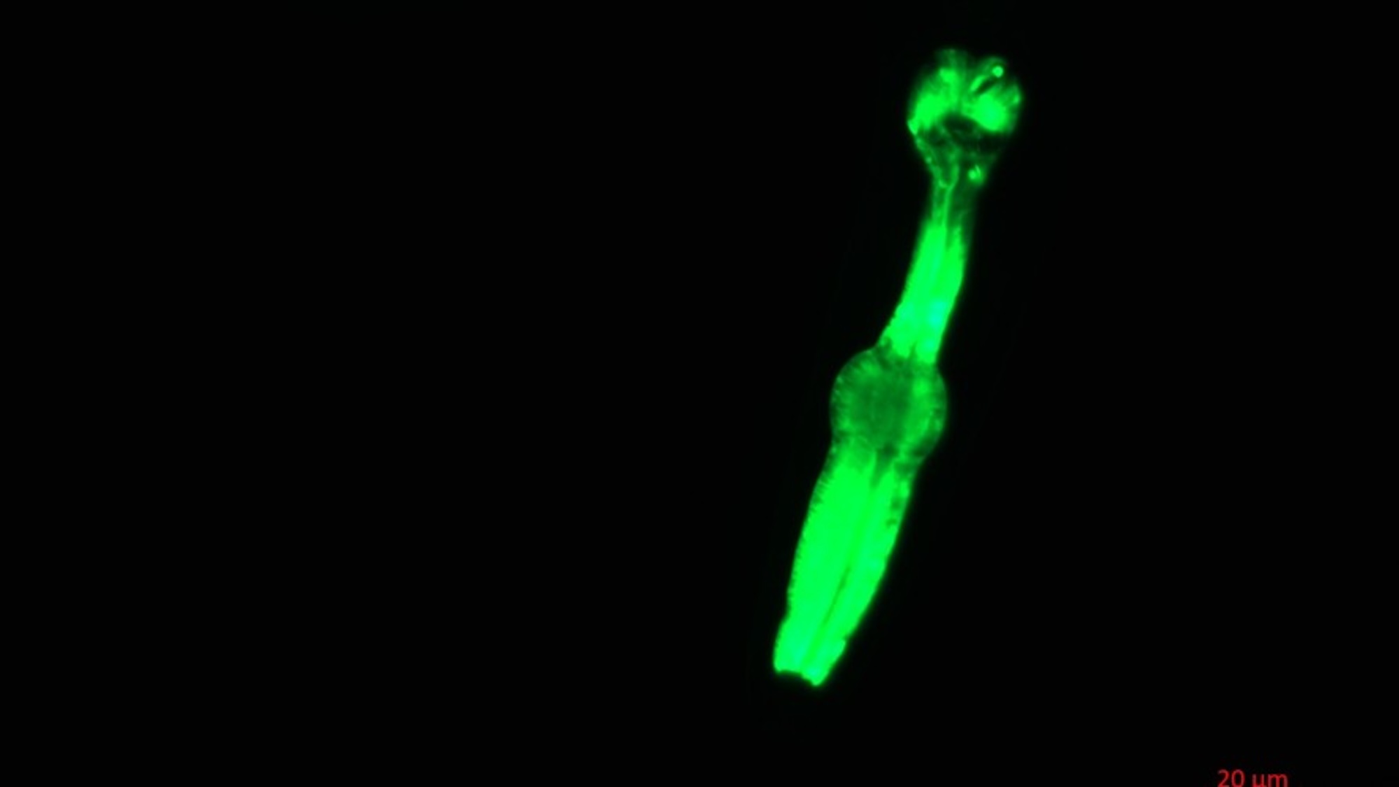 Fluorescent image of nematode