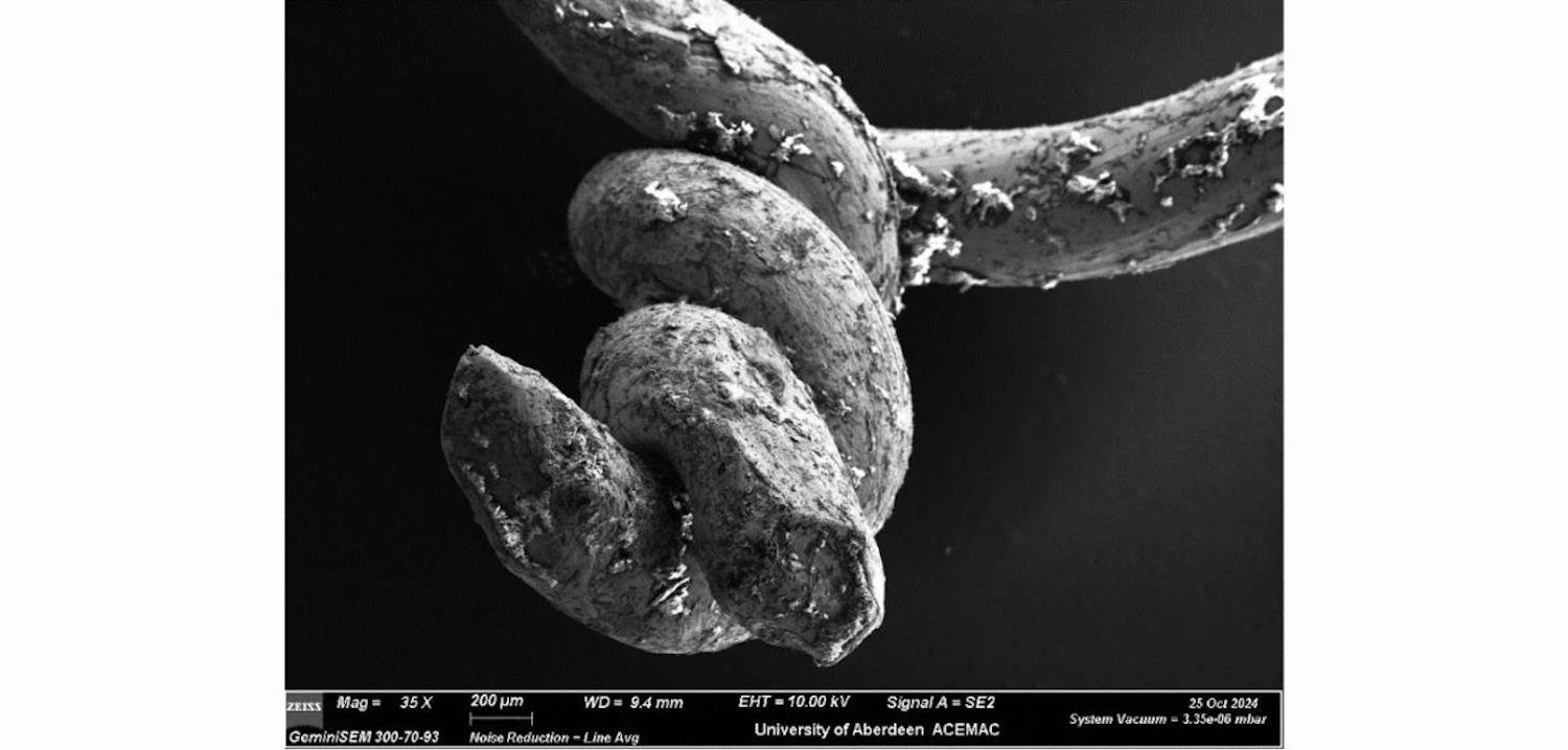 35x magnification of the knotted end of the dental ligature. Credit: Dittmar, et al.
