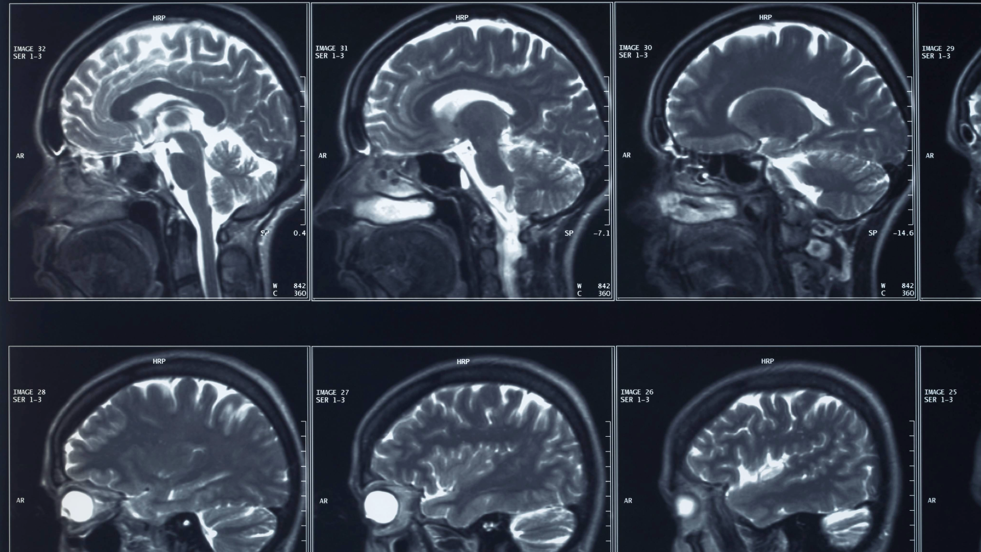 brain x rays