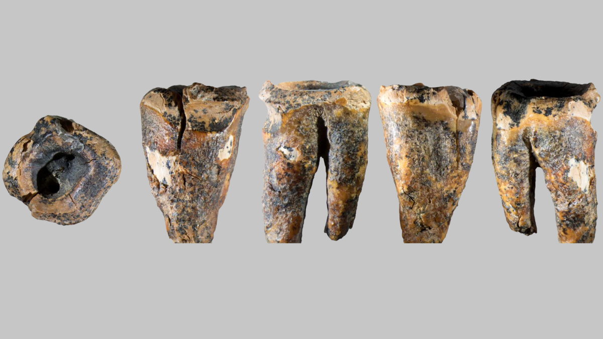 Neanderthal ‘dentists’ treated cavities 59,000 years ago
