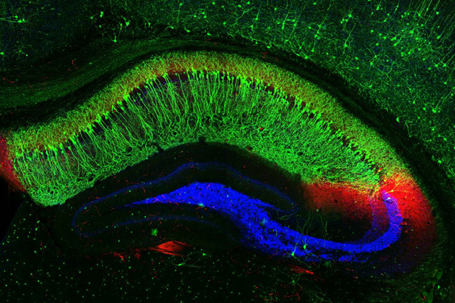 Bight green curved shape with red on one side and a tongue of blue that circles underneath. The image appears to be some sort of fluorescent scan. 