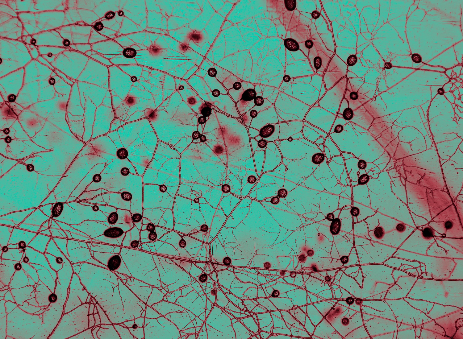 621 trillion miles of fungi networks crisscross the planet