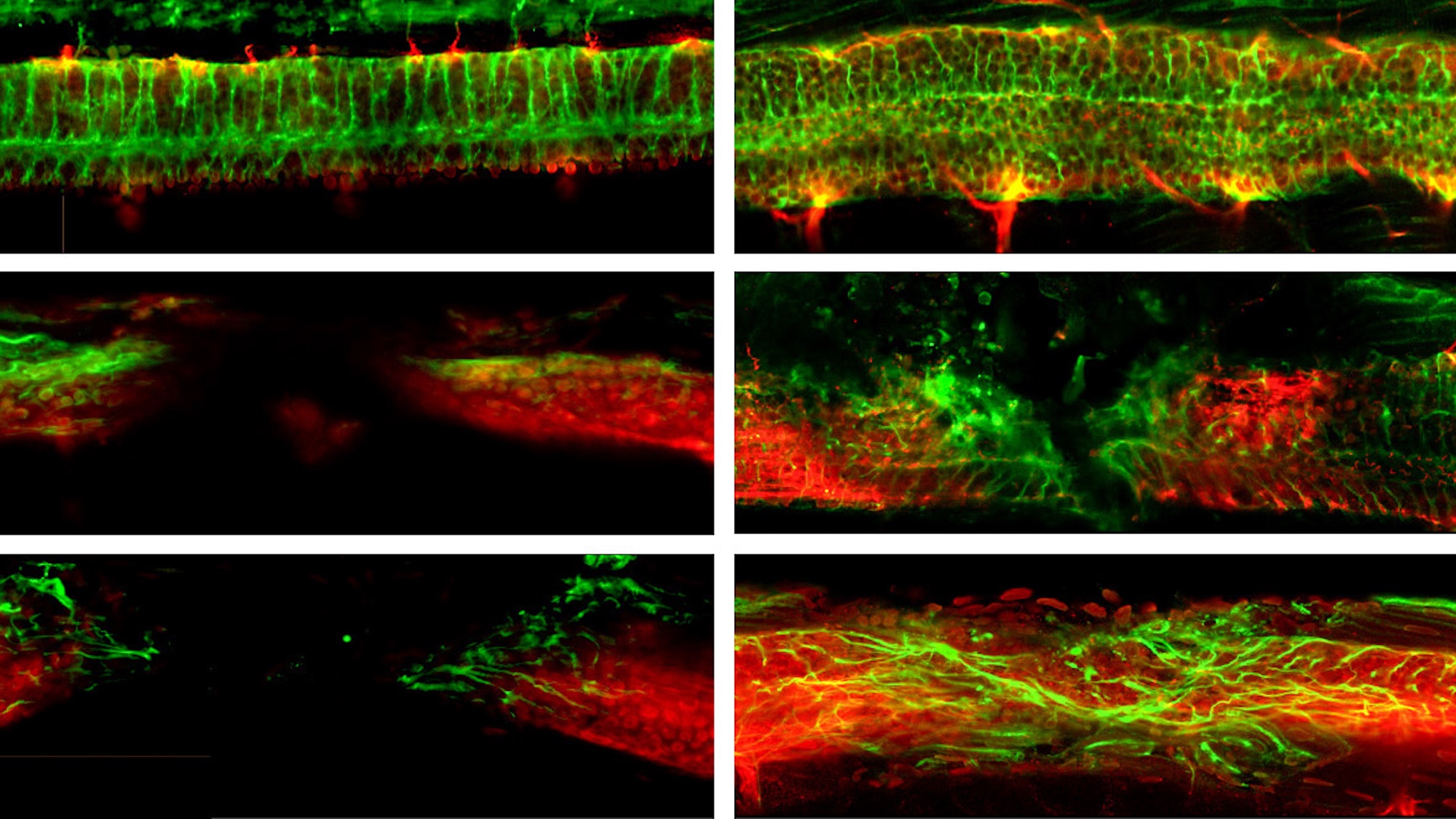 At the start and after three days: the top images show the uninjured spinal cord of a zebrafish; those in the middle show the injured spinal cord; and those at the bottom illustrate how the nerve cells grow thanks to the microrobots. (Image: ETH Zurich)