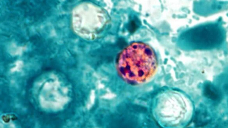 a microscope image of a parasite. it is round and red