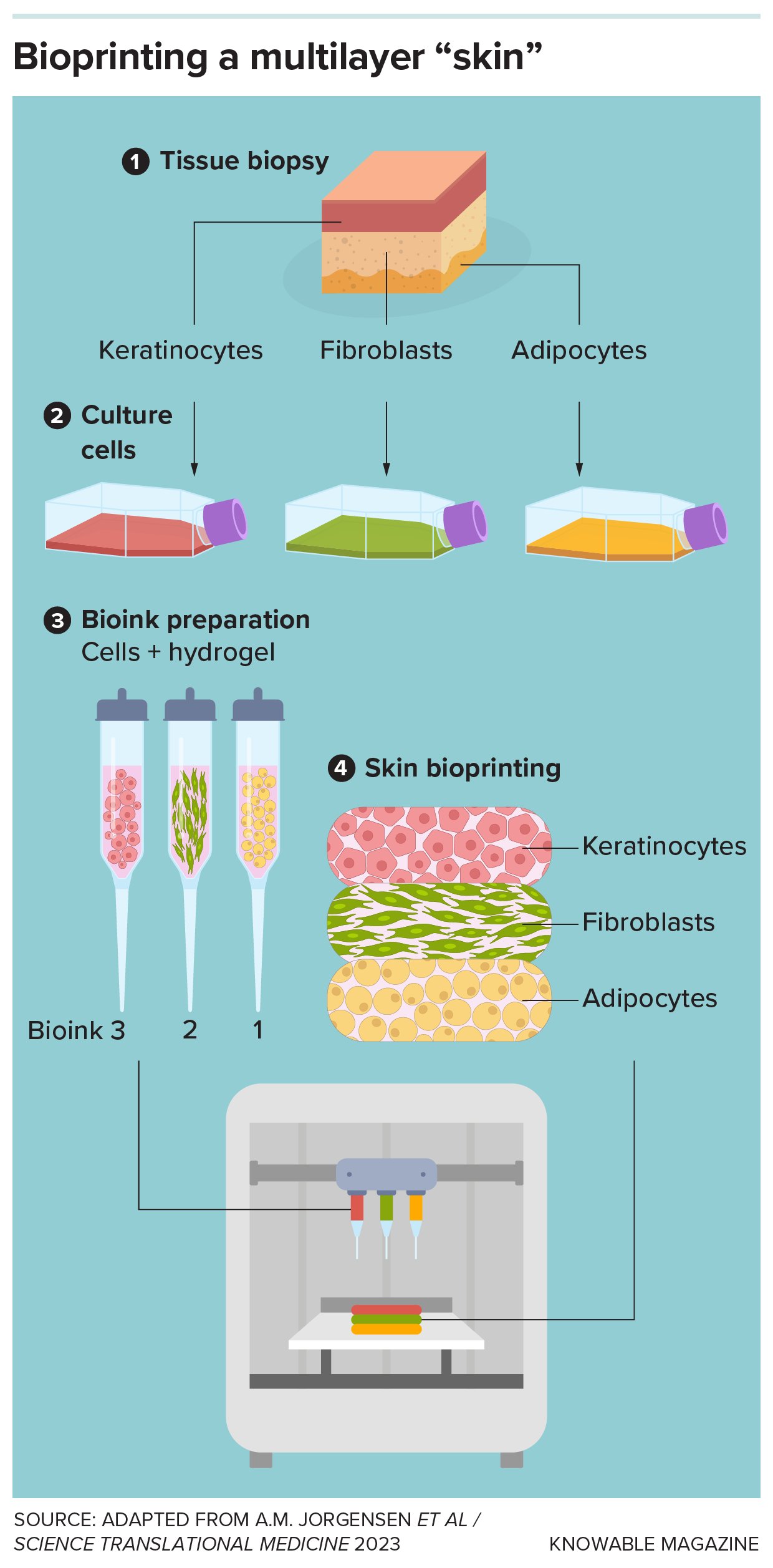 Bioprinting basics Graphic shows the steps to print a three-layer skin.