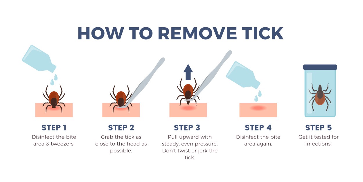 Tick How The dos and don'ts of removing a tick | Popular Science