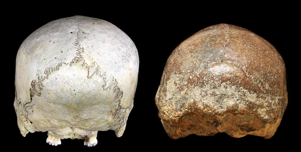 Back views of the skulls of a historical human (left) and a Homo erectus from Ngawi, Java (right: undated), exhibiting severe transverse deformational plagiocephaly. Image: Kaifu Y et al. 2026 CC BY.
