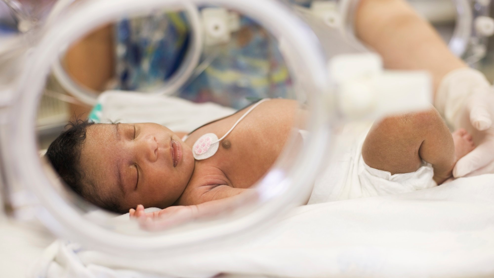 Parents of premature newborns can have more skin-to-skin contact with new device