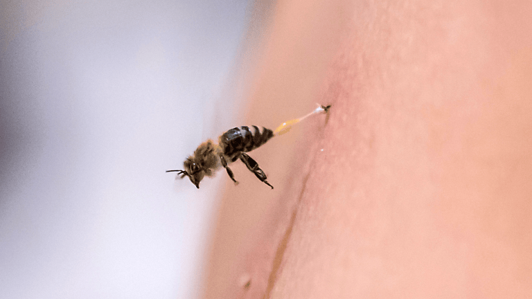 a bee stinging human skin