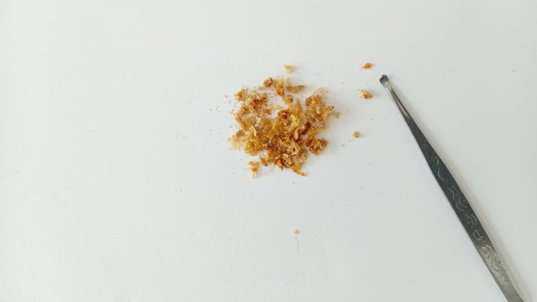 Closeup of ear wax and pick tool on top